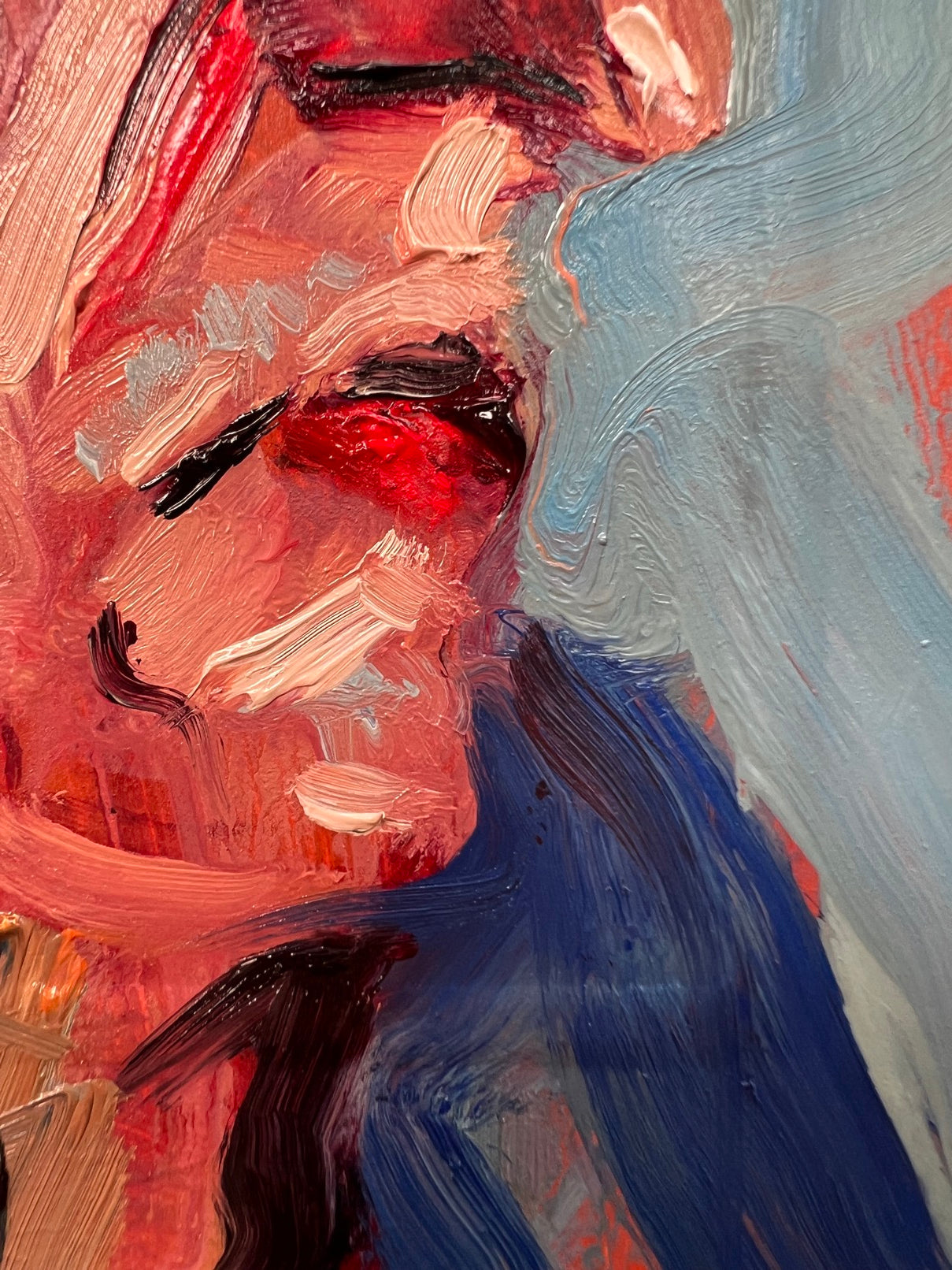 Commotion cérébrale (AGS)