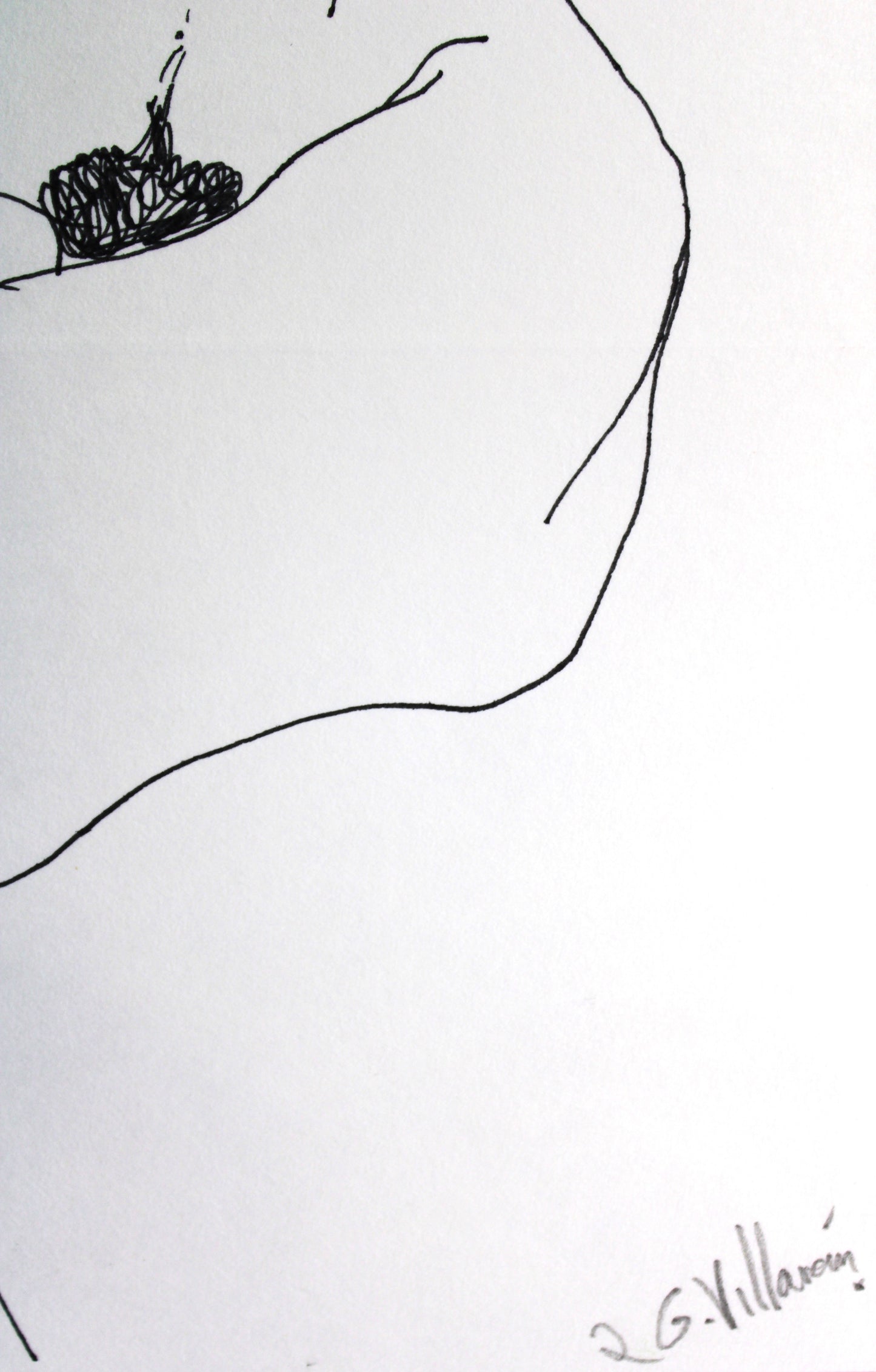 Atrocious foreshortening