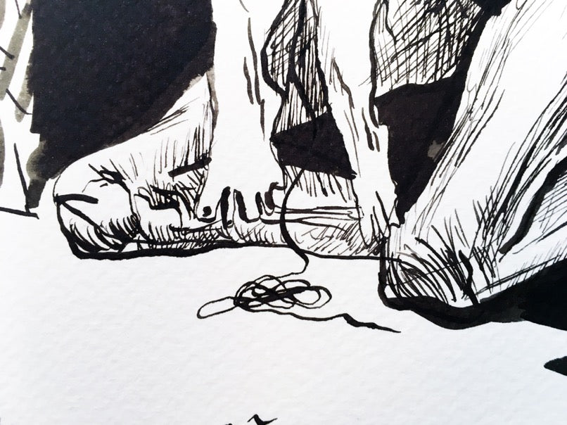 An old woman sews the skin of a child